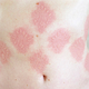 Illustration for article titled Skin Etching Artist Explores Our Relationship With Our Bodies
